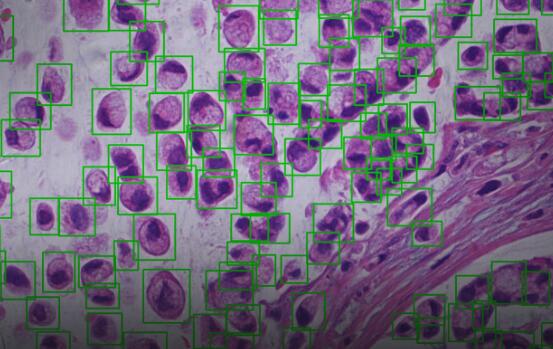 医学图像检测鉴别等分析解决方案 商汤
